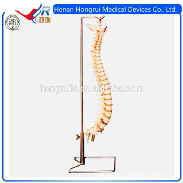 Модель ISO Advanced Flexible Spine